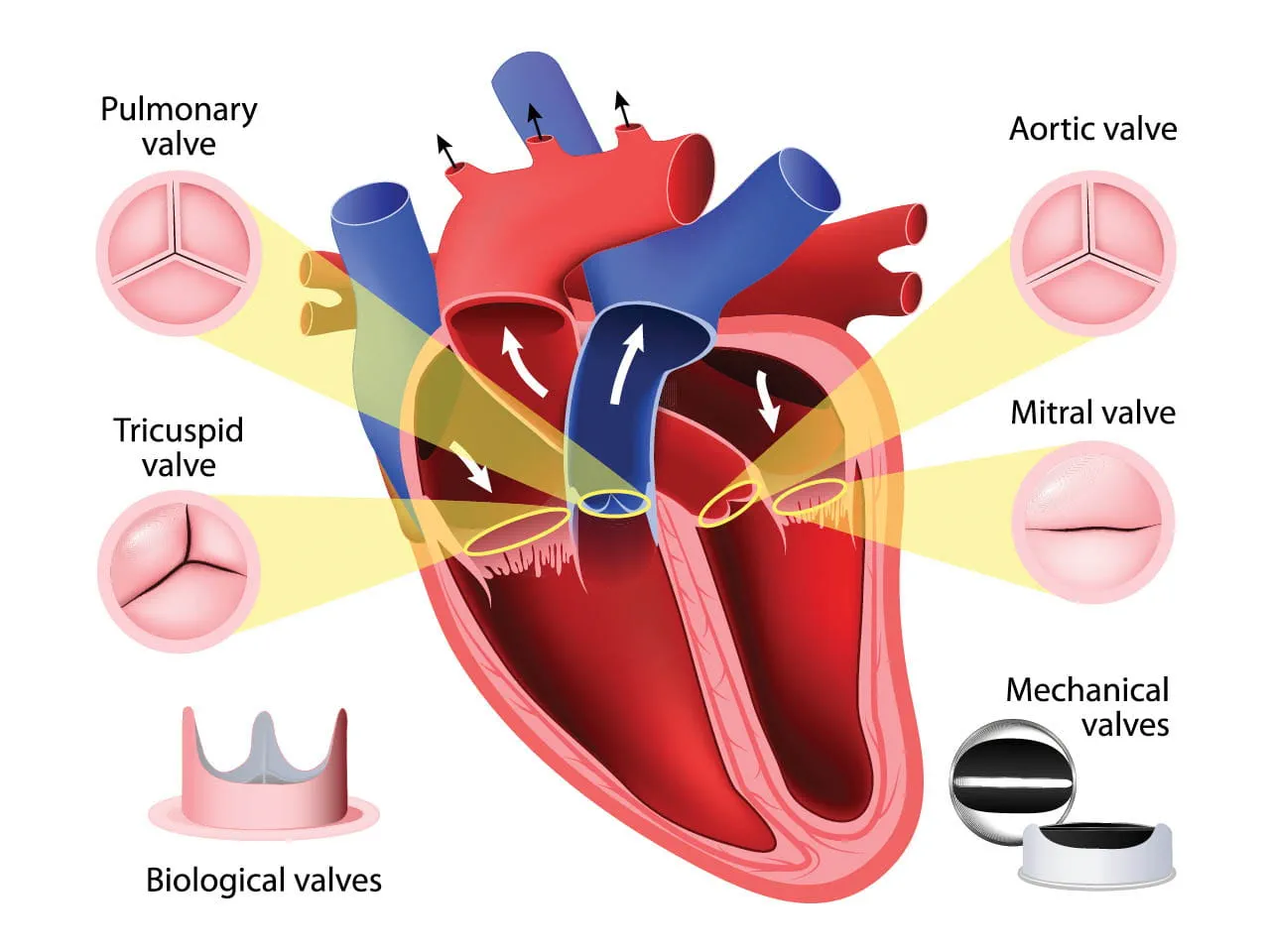 Heart Valve Surgery in Prescott